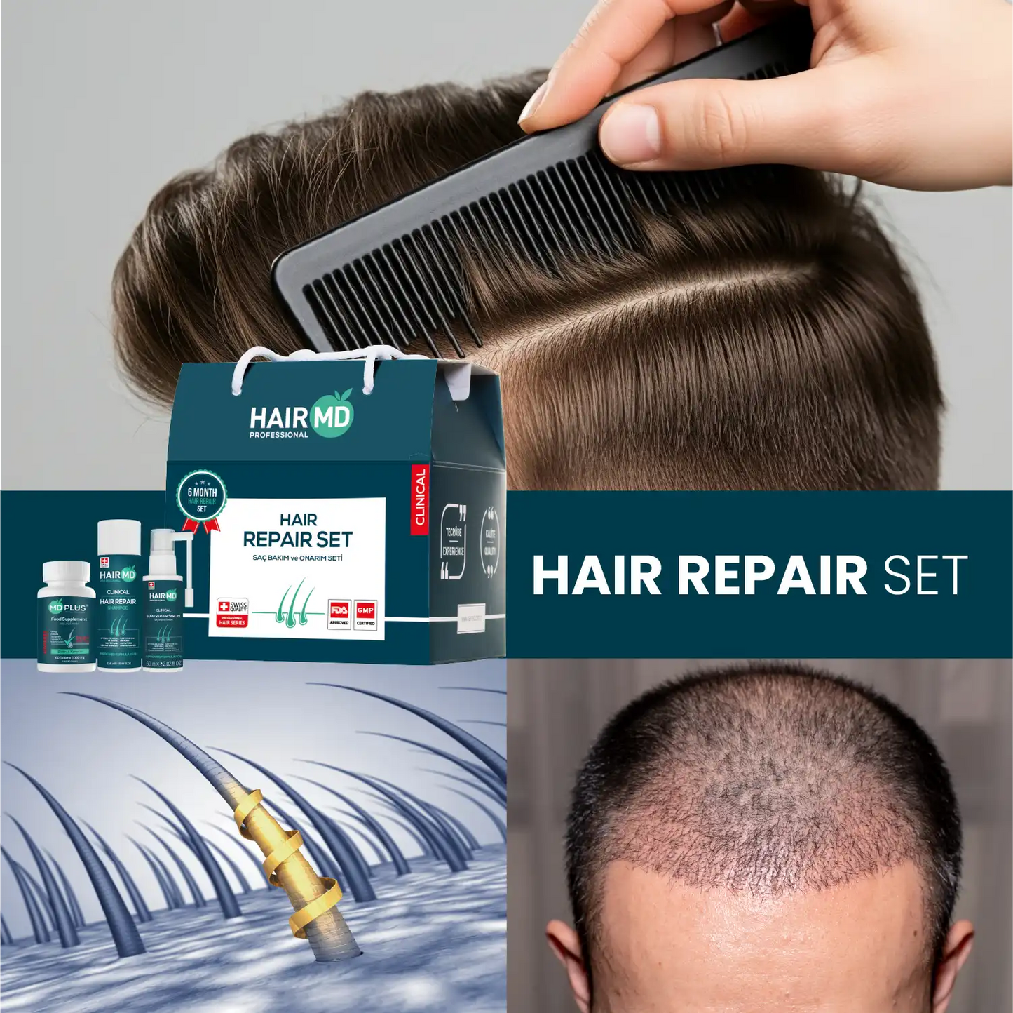 HairMD Clinical Haarherstel Set (6 maanden gebruik)