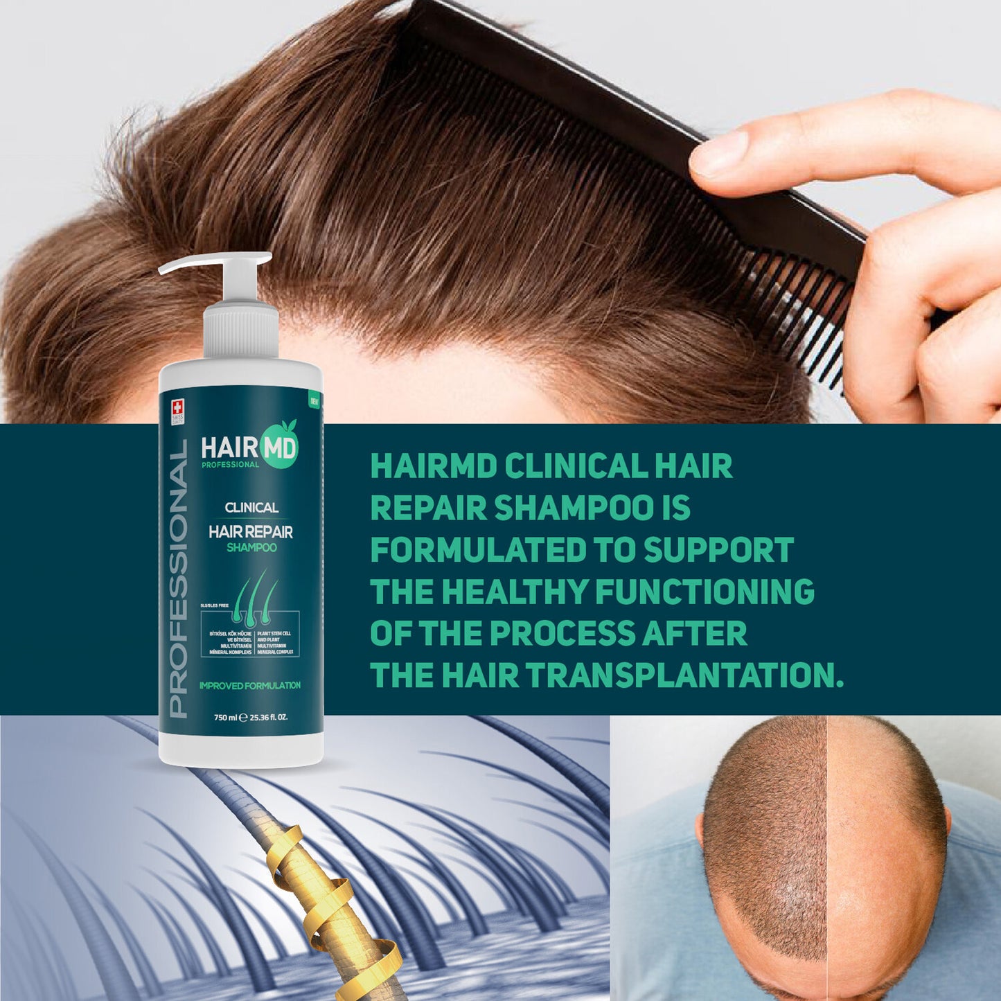 HairMD Herstellende Shampoo