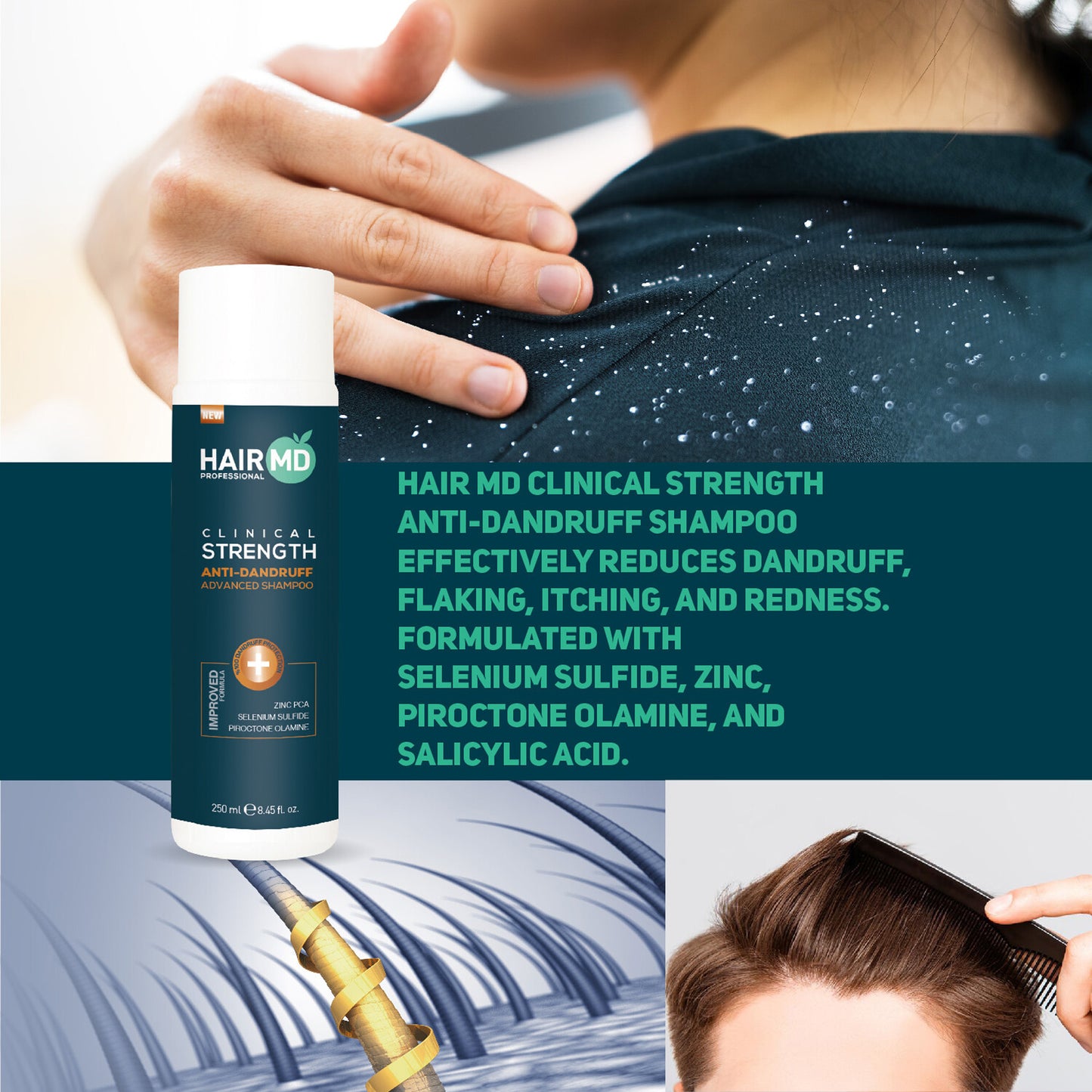 HairMD Clinical Strength Anti Dandruff Advanced Shampoo