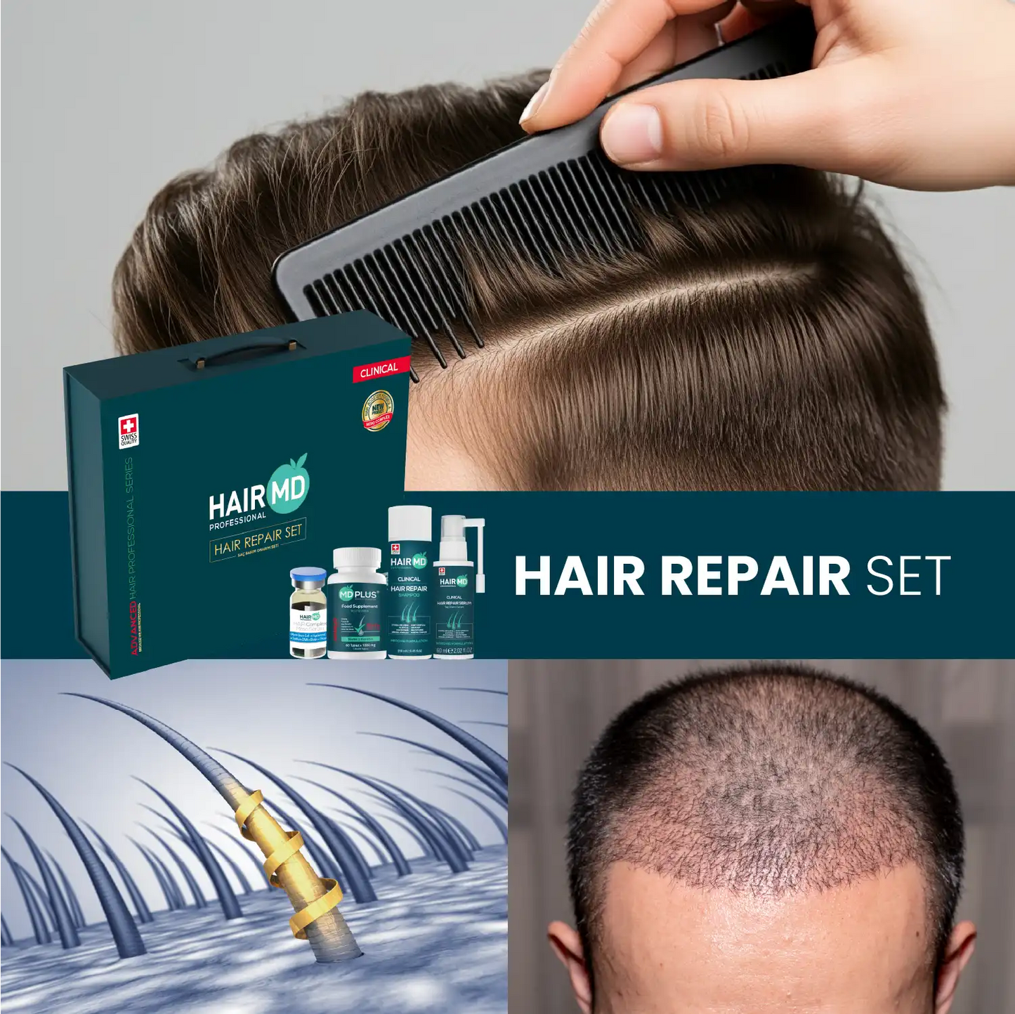 HairMD Clinical Haarherstel Exclusieve Set (3 maanden gebruik)