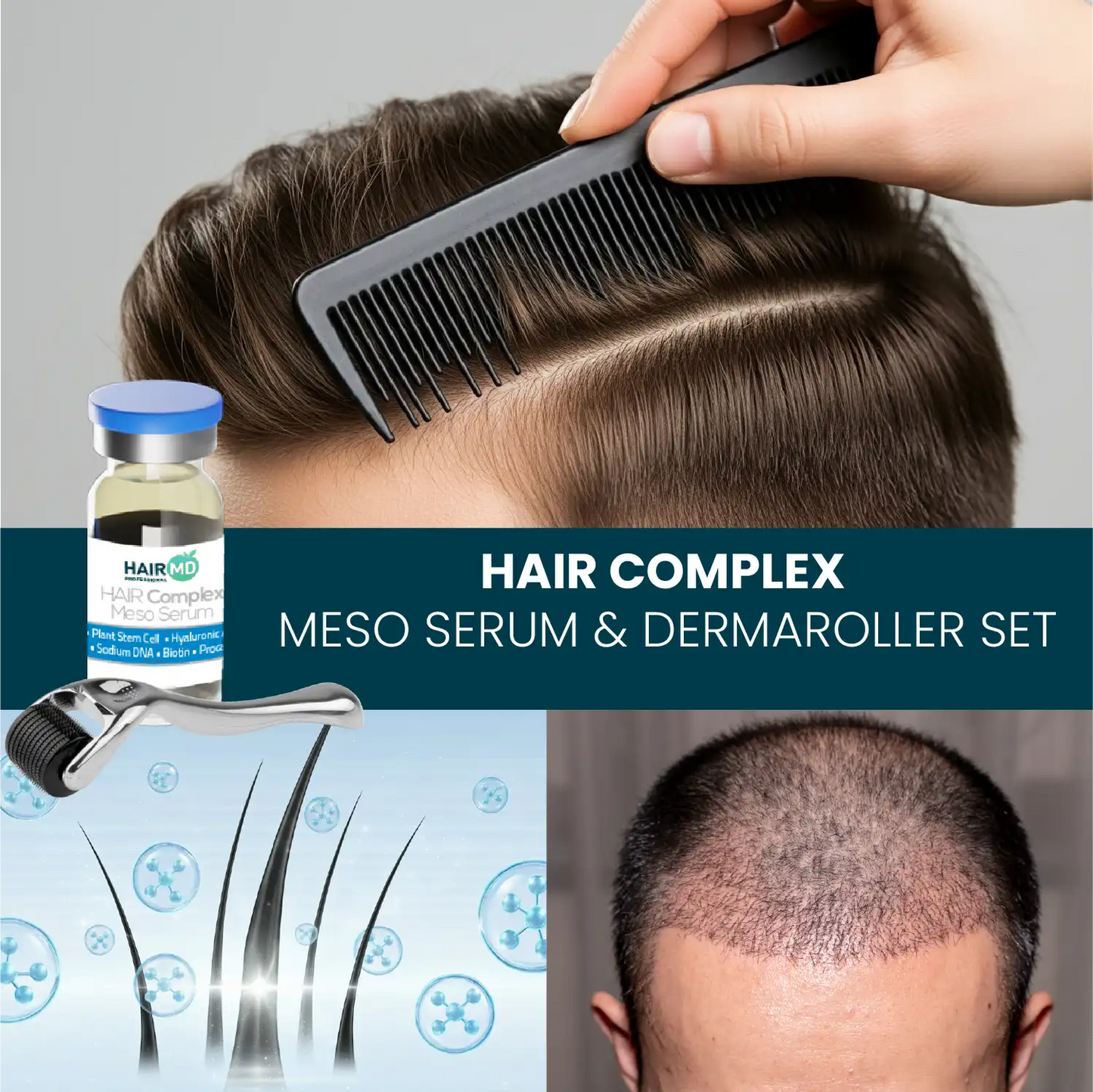 HairMD Clinical Haarcomplex Meso Serum + Dermaroller Set