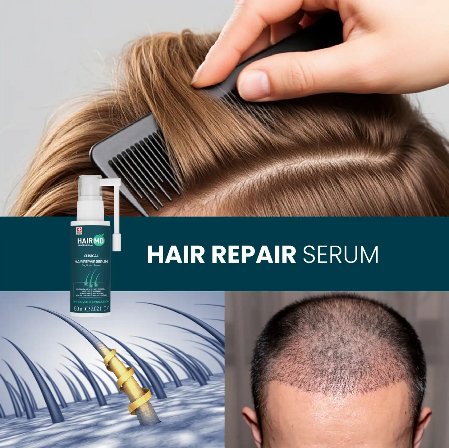 HairMD Clinical Haarherstel Serum