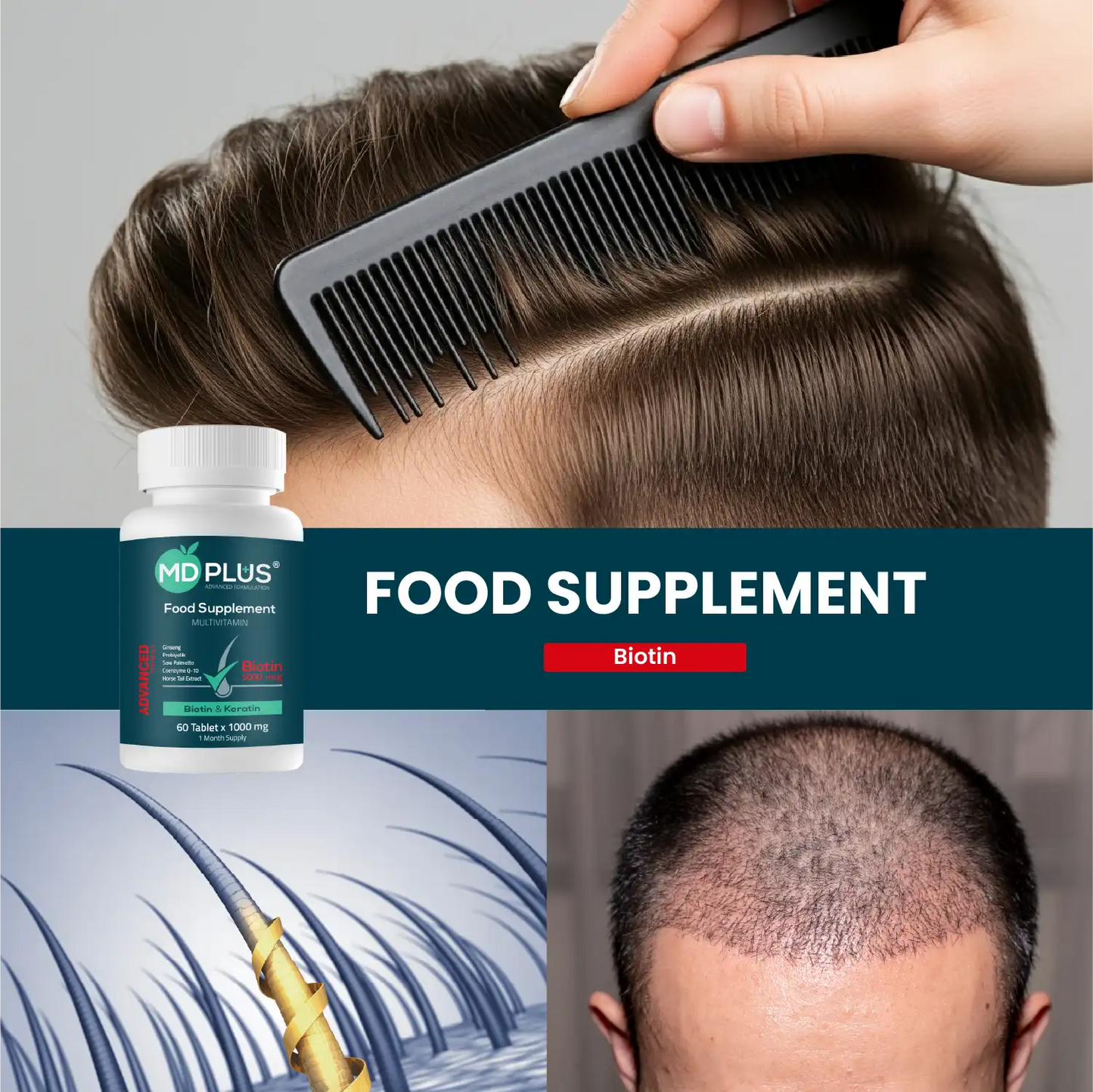 MD Plus Geavanceerde Haar Biotine 5000 mcg
