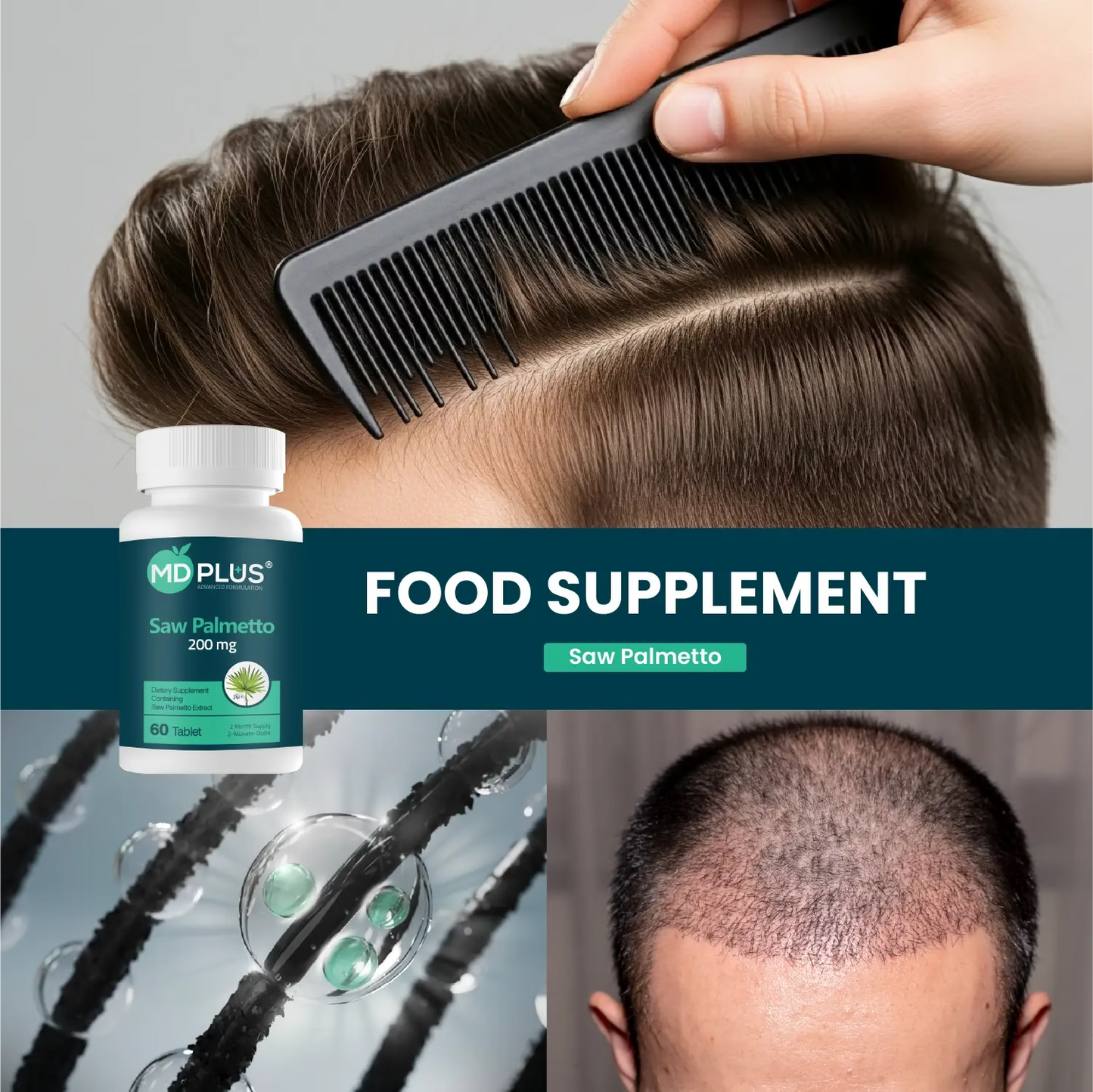 MD Plus Geavanceerde Haar Zaagpalm 200 mg 60 Tabletten